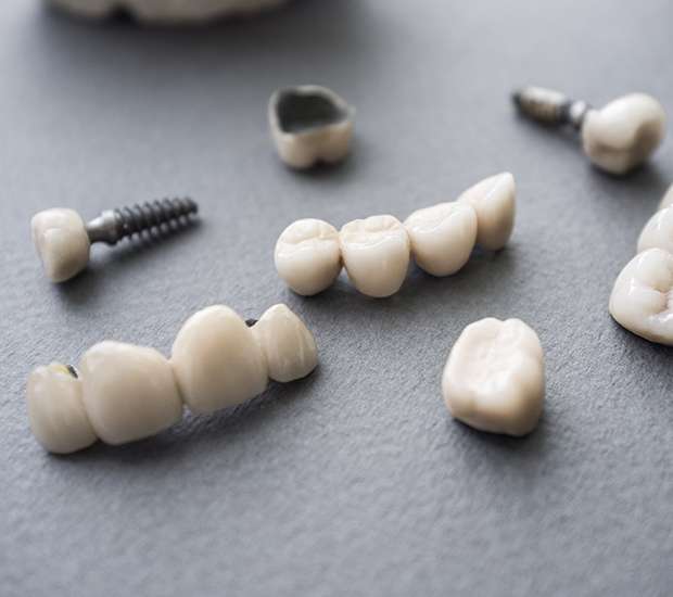 Anderson The Difference Between Dental Implants and Mini Dental Implants