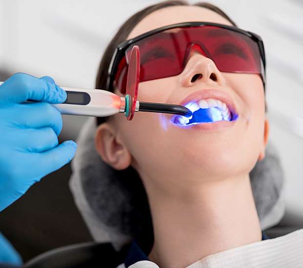 Anderson Professional Teeth Whitening